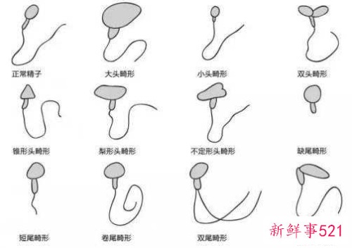 精子畸形率97正常吗