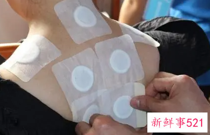 贴三伏贴需要提前检查吗