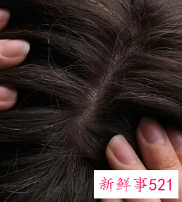 头发缺少营养怎么补