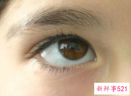 女孩单眼皮有什么好处