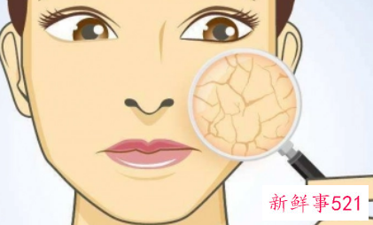 脸部每天补水好吗