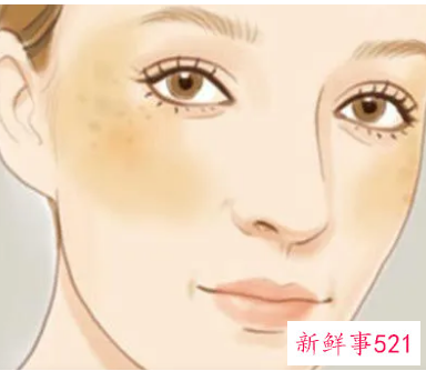 脸比较粗糙怎么办