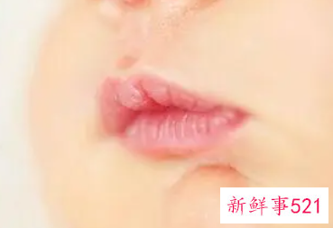 新生儿混合喂养嘴唇干咋回事