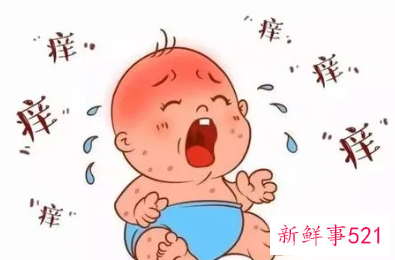 什么是湿疹性皮炎