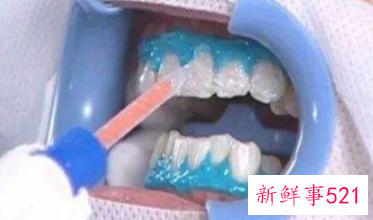 冷光美牙仪对牙齿有伤害吗