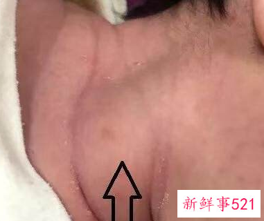 宝宝脖子歪右边纠正图