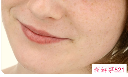 面部长斑与内脏对应图