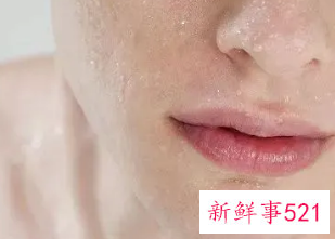 皮肤缺水会导致哪些问题