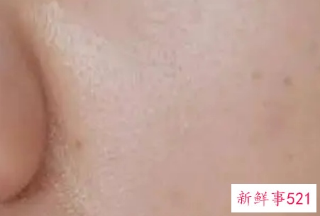 告诉你油性肌肤的清晨