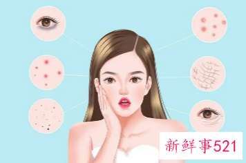 怎么改善皮肤毛孔粗大黑头