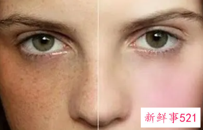 面部长斑与内脏对应图