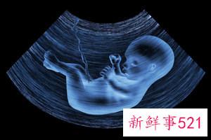 感冒吃什么水果好得快点