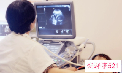 孕期检查都有哪些例检项目