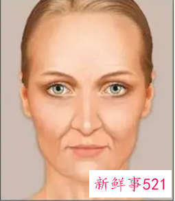 38岁脸部下垂怎样改善