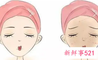 如何有效改善皮肤暗沉