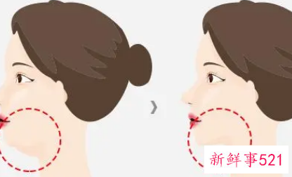 减双下巴有效的运动