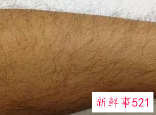 梦见汗毛什么意思