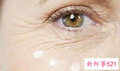 激光去除鱼尾纹有什么优势