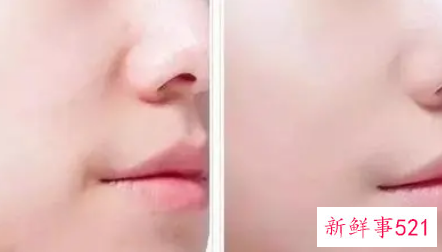 脸部每天补水好吗