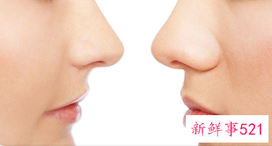 耳软骨隆鼻可以维持一辈子吗