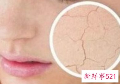 皮肤缺水后有哪些肌肤问题