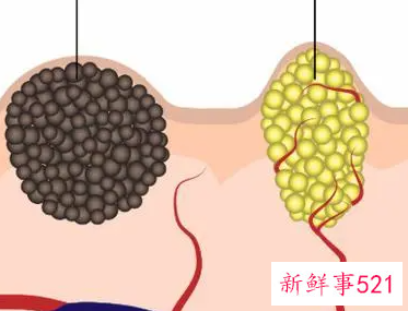 有什么办法去黑色素