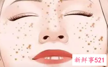 祛斑以后要注意事项