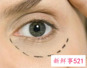 怎么样才能让眼窝变深