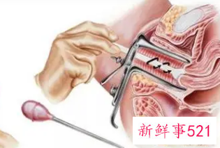 女人梦见自己妇科检查