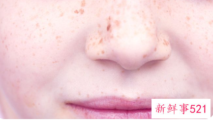 面部长斑与内脏对应图