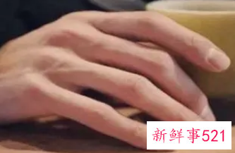 怎样使手变得白嫩好看男生