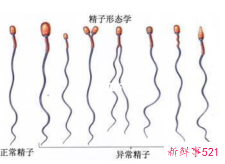 精子畸形率97正常吗