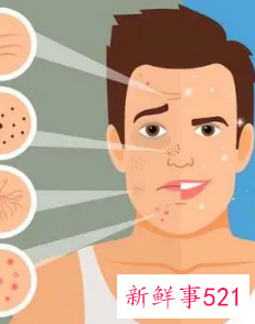 男人的脸怎么保养又白又光滑