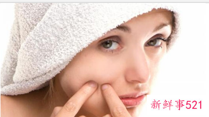 如何自制祛痘的面膜