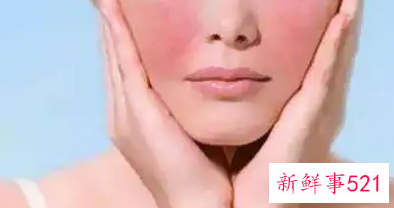 缓解肌肤紧张的脸部运动