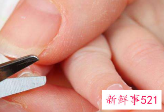 手指甲有几种类型