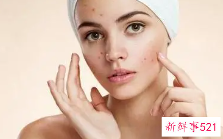 最先进的祛斑方法有哪些