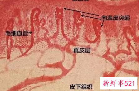 怎样自己在家修复红血丝