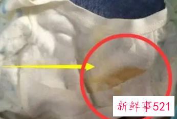 内裤上黄黄的是尿渍还是分泌物