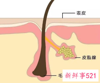 皮肤干燥缺什么