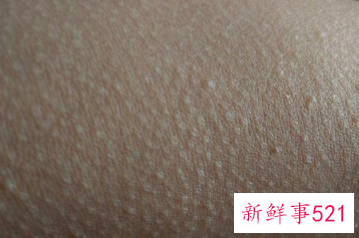 去腿上鸡皮肤有效的方法