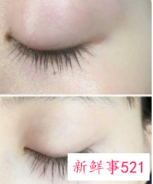 睫毛增长液到底有用吗有副作用吗