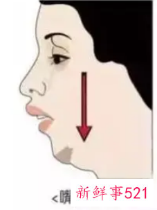 张嘴睡觉嘴唇会变厚吗