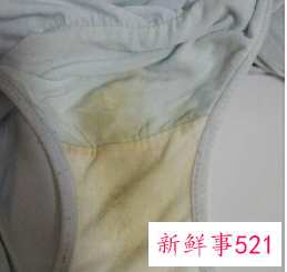 内裤上黄黄的是尿渍还是分泌物