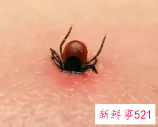 被蜱虫咬了该怎么办
