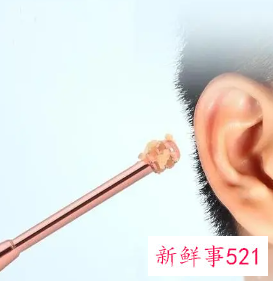 清理耳屎去医院挂什么科