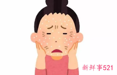 皮肤干燥缺什么