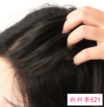 秃顶怎么办才能长头发