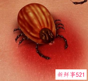 被蜱虫咬了该怎么办