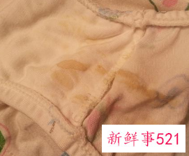 内裤上黄黄的是尿渍还是分泌物